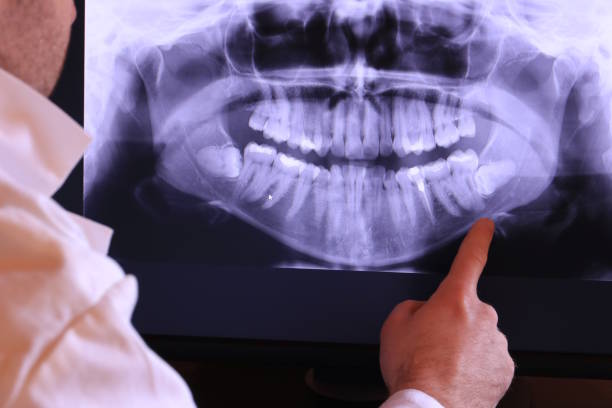 Best Pediatric Emergency Dentist in Palm Valley, TX