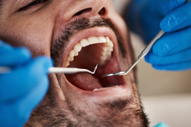 Best Emergency Cosmetic Dentistry in Palm Valley, TX